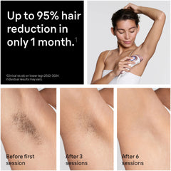 Braun Smart IPL, Skin i·Expert Pro 7: At Home Alternative to Laser Hair Removal with 3 Caps, Facial Hair Trimmer, and Leather Pouch, IPL7219