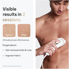 Braun Smart IPL, Silk·Expert Pro 5: At Home Alternative to Laser Hair Removal with Wide Cap and Leather Pouch, IPL5145